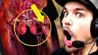 TIR DANS LES TESTICULES !! (Sniper Elite 4)