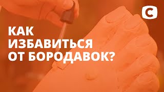 Как навсегда избавиться от бородавок в домашних условиях?