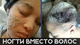 НОГТИ ВМЕСТО ВОЛОС [Шокирующая реальность #67]