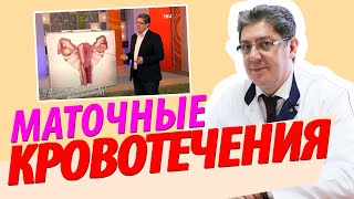 Маточные кровотечения: причины, как остановить, лечение