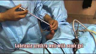 Bipolar turp 4 How to dilate the urethra and insert the resectoscope sheath