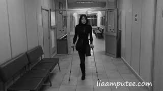 Amputee girl crutching in hospital