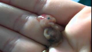 6 Week Old Fetus Pictures Compilation| Picture Of 6 Week Old Fetus Best