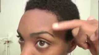 Natural Alopecia Treatment HAIR GROWTH Results :  Month 3