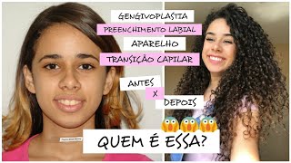 TODOS OS PROCEDIMENTOS ESTÉTICOS QUE JÁ FIZ - Thainá Alves