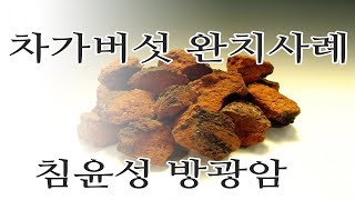 침윤성방광암 판정 후 방광적출 거부하고 차가버섯 복용만으로 완치 사례