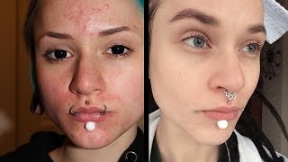 Моя голая кожа | ДО и ПОСЛЕ использования LUSH
