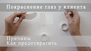 Покраснение глаз после наращивания ресниц