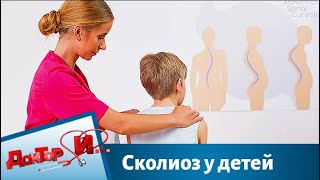 Сколиоз у детей | Доктор И