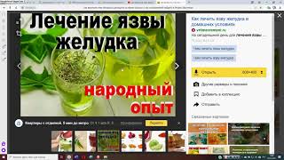 Как вылечить язву желудка, гастрит рюфлекс и панкреатит, реальный опыт человека который выжил