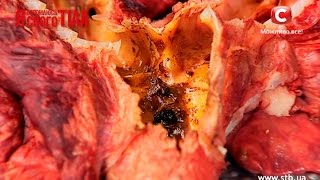 Людмила Шупенюк покажет, как выглядят легкие курильщика  - Я соромлюсь свого тіла