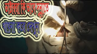 ডাঃ কেমন করে সুন্নতে খাৎনা করে দেখুন । Doctor kemon kore sunnote khatna kore dekhun ।সুন্নতে খাৎনা।