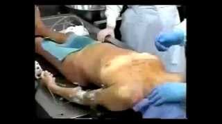 autopsy 1