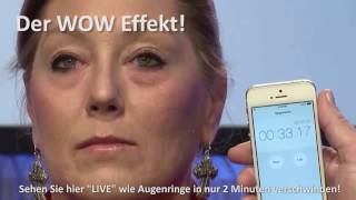 Tränensäcke und Augenringe weg in 2 Minuten! Gratis Probe anfordern