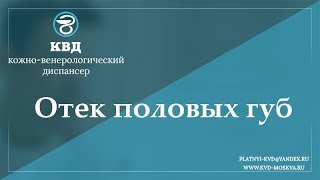 759  Отек половых губ