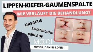 Wie behandelt man eine Lippen Kiefer Gaumenspalte? | 9 Fragen an Dr. Daniel Lonic | MOOCI