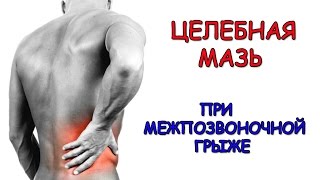 Межпозвоночная грыжа. Целебная мазь при межпозвоночной грыже.