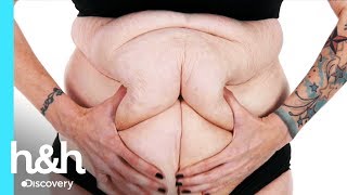 Aprovada para a cirurgia | Emagreci, E Agora? | Discovery H&H Brasil