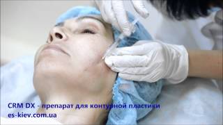 Обучение инъекциям гиалуроновой кислоты CRM DX видео