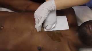 New York Male Hair Removal: Chest Waxing For Men in Manhattan NY (Azulene Wax)