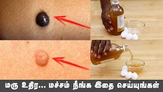 Remove Skin Tag and Mole Without Surgery | Nature Nurture