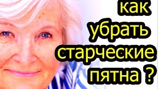 Возрастная пигментация: как убрать старческие пятна на коже? ПРОСТОЙ ЭФФЕКТИВНЫЙ СПОСОБ  # топ5хайп