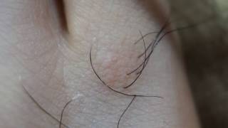 La depilación para el cuidado de la piel de la chica de belleza 002. con microscopio