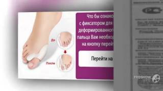 valgus pro купить в аптеке

  - Скидка до 60% на ортопедический фиксатор