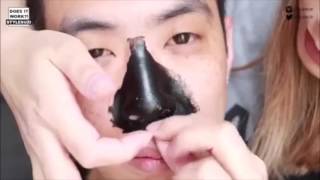 Черные Точки На Руках [Черные Точки На Руках]