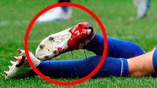 Las PEORES LESIONES del Mundo del FÚTBOL