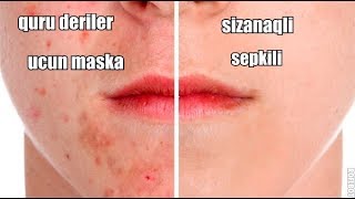 sizanaqlar, sepkiler ve quru deriler ucun maska