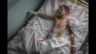 9yo Vladik sees his mother killed buy Ukraine Shelling: Donetsk Protest