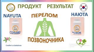 NAYUTA  КАК ПОМОЧЬ ПРИ ПЕРЕЛОМЕ ПОЗВОНОЧНИКА   НАЮТА