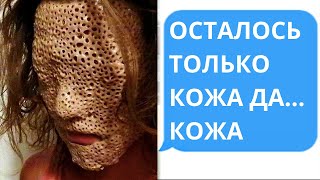Осталось только кожа, да кожа.  Страшные истории.
