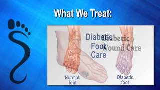 Foot Doctor in Beverly Hills | Call Dr. Michael Bilinsky (310) 692-7250