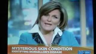 CHEMTRAiLS/ MORGELLONS KiLLS!!!!!!! MUST SEE!!!!!!! 100% TV MEDiA PROOF