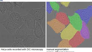 5 Minute Teaser Presentation of the U-net: Convolutional Networks for Biomedical Image Segmentation
