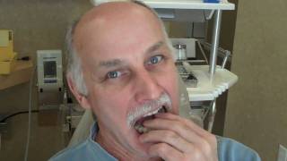 Shelby Dentist Provides Snap on Smile to Dental Patient in Michigan