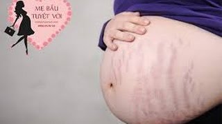 Bí quyết để Bà Bầu không Rạn Da khi mang thai bảo đảm hiệu quả 100%