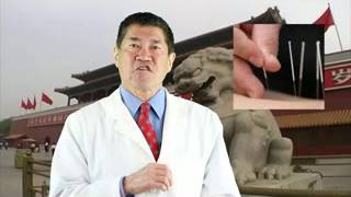 Osteoarthritis | acupuncture knee oa