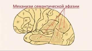 Семантическая афазия. Теоретическая часть.