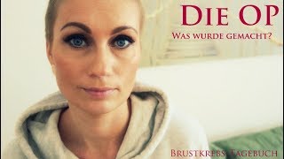 BRUST(KREBS)OP - Was wurde gemacht?