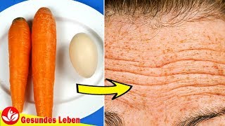Wie Man Falten In 7 Tagen Zu Entfernen || Stirnfalten Entfernen Mit Diesen 2 Natürliche Zutaten