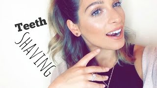 TEETH SHAVING | my experience & results