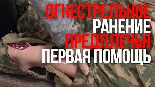 Повреждение предплечья | Огнестрельное ранение | Первая помощь