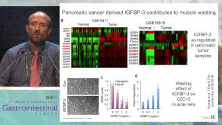 Cancer cachexia and sarcopenia in GI cancer: Mechanism and ways to interfere with it