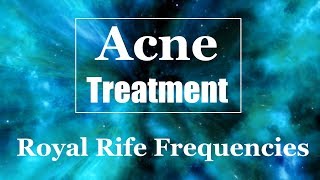 Acne Treatment  -  8 Rife Frequencies - 2720, 2170, 1800, 1600, 1500, 880, 787, 564