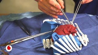 El hospital donde imprimen corazones de niños en 3D