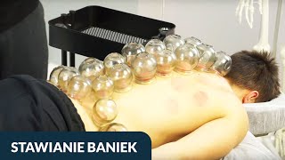 Techniki stawiania baniek | Darmowa lekcja | Kurs stawiania chińskich baniek ogniowych - Holiapp.me