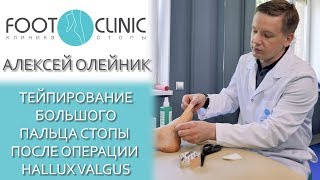 Hallux Valgus реабилитация. Тейпирование 1-го пальца.